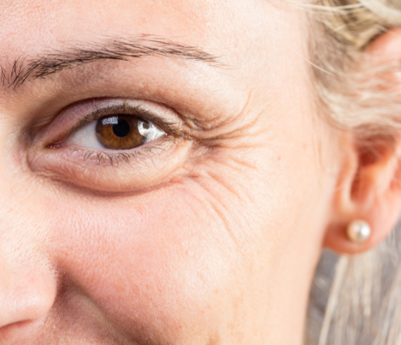 Increasing Fine Lines